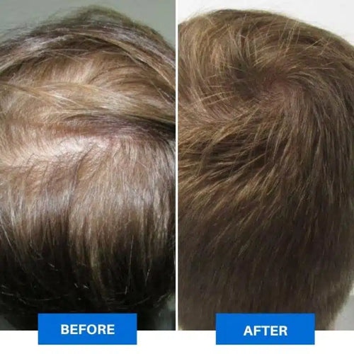 Sherani™ Smart Scalp Massager – Hair Growth & Deep Relaxation Therapy